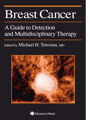 cover image of Breast Cancer